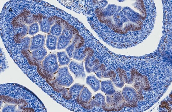 SOX 9 antibody recombinant, expressed in HEK 293 cells