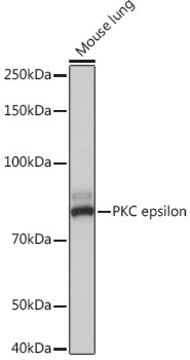 Anti-PKC epsilon Antibody, clone 8I8K4, Rabbit Monoclonal