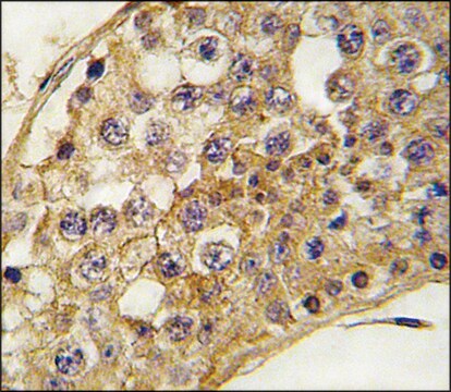 Anti-PROK1 (center) antibody produced in rabbit saturated ammonium sulfate (SAS) precipitated, buffered aqueous solution