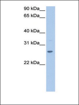 Anti-CRISP1 antibody produced in rabbit affinity isolated antibody