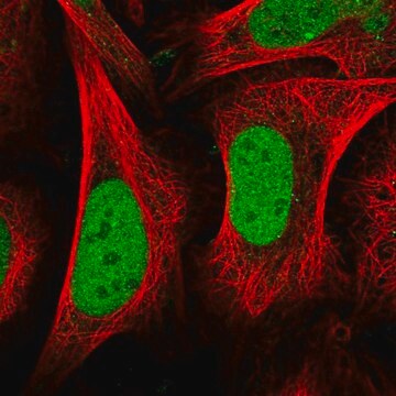 Anti-CENPQ antibody produced in rabbit Prestige Antibodies&#174; Powered by Atlas Antibodies, affinity isolated antibody