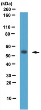 Anti-RGS11 (CT) Antibody from rabbit