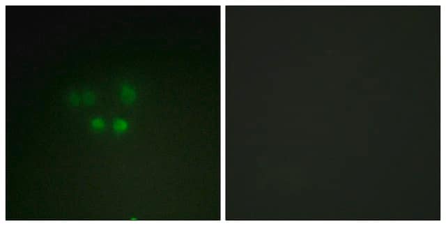 Anti-Nibrin antibody produced in rabbit affinity isolated antibody