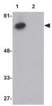 Anti-ACVR1B Antibody from rabbit, purified by affinity chromatography