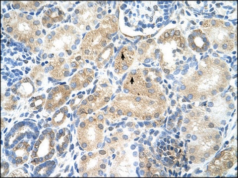 Anti-MAT1A (AB1) antibody produced in rabbit IgG fraction of antiserum