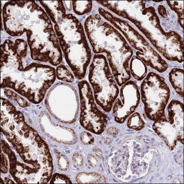 Anti-IGF1R antibody produced in rabbit Prestige Antibodies&#174; Powered by Atlas Antibodies, affinity isolated antibody, buffered aqueous glycerol solution