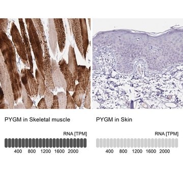 Anti-PYGM antibody produced in rabbit Prestige Antibodies&#174; Powered by Atlas Antibodies, affinity isolated antibody, buffered aqueous glycerol solution