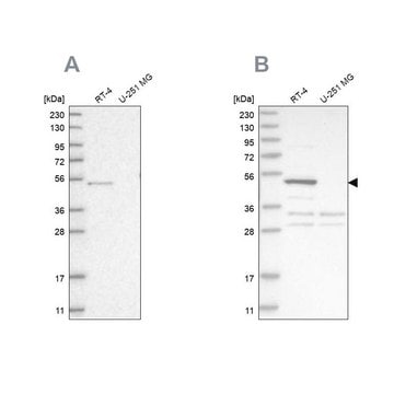 Anti-SCP2 antibody produced in rabbit Prestige Antibodies&#174; Powered by Atlas Antibodies, affinity isolated antibody, buffered aqueous glycerol solution