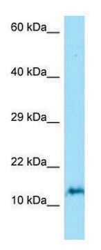 Anti-ORMDL3 (N-terminal) antibody produced in rabbit affinity isolated antibody