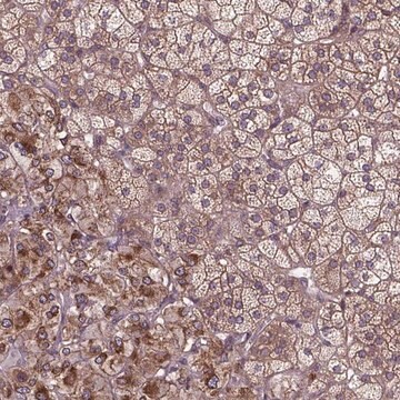 Anti-ZNF616 antibody produced in rabbit Prestige Antibodies&#174; Powered by Atlas Antibodies, affinity isolated antibody, buffered aqueous glycerol solution