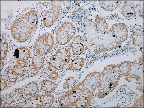 Anti-TRIM49 affinity isolated antibody