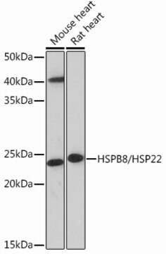 Anti-HSPB8/HSP22 Antibody, clone 3K10W1, Rabbit Monoclonal