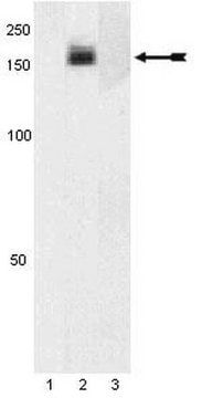 Anti-phospho-PDGFR&#945; (Tyr754) Antibody Upstate&#174;, from rabbit