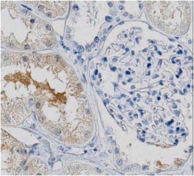 Anti-SLC38A3 Antibody, clone 1A10.2 clone 1A10.2, from mouse