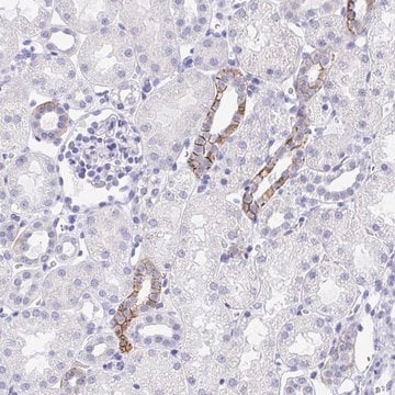 Anti-MON1A antibody produced in rabbit Prestige Antibodies&#174; Powered by Atlas Antibodies, affinity isolated antibody, buffered aqueous glycerol solution