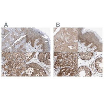 Anti-GCN1 antibody produced in rabbit Prestige Antibodies&#174; Powered by Atlas Antibodies, affinity isolated antibody, buffered aqueous glycerol solution, Ab1