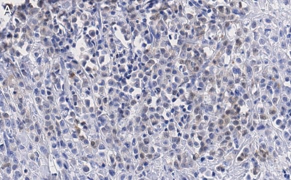 Anti-SSNA1 Antibody, clone 4C4 ZooMAb&#174; Rabbit Monoclonal recombinant, expressed in HEK 293 cells