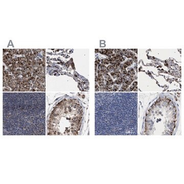 Anti-HSD17B4 antibody produced in rabbit Prestige Antibodies&#174; Powered by Atlas Antibodies, affinity isolated antibody, buffered aqueous glycerol solution, Ab2