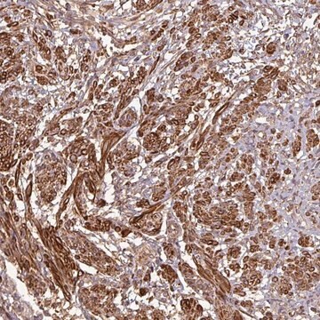 Anti-MAP3K6 antibody produced in rabbit Prestige Antibodies&#174; Powered by Atlas Antibodies, affinity isolated antibody, buffered aqueous glycerol solution