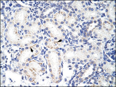 Anti-SNRPA1 antibody produced in rabbit IgG fraction of antiserum