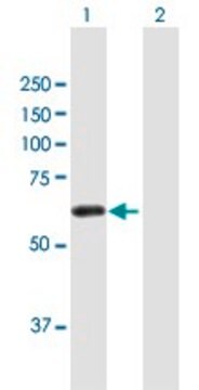 Anti-ZSCAN21 antibody produced in mouse purified immunoglobulin, buffered aqueous solution