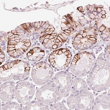 Anti-ANKRD20A4 antibody produced in rabbit Prestige Antibodies&#174; Powered by Atlas Antibodies, affinity isolated antibody, buffered aqueous glycerol solution