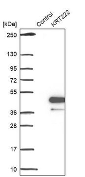 Anti-KRT222 antibody produced in rabbit Prestige Antibodies&#174; Powered by Atlas Antibodies, affinity isolated antibody, buffered aqueous glycerol solution