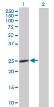 Anti-AGPAT2 antibody produced in mouse purified immunoglobulin, buffered aqueous solution