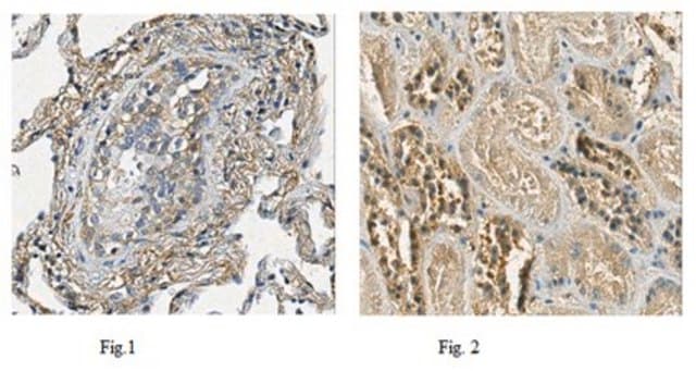 Anti-PTK7 Antibody, clone 4F9 ascites fluid, clone 4F9, from mouse