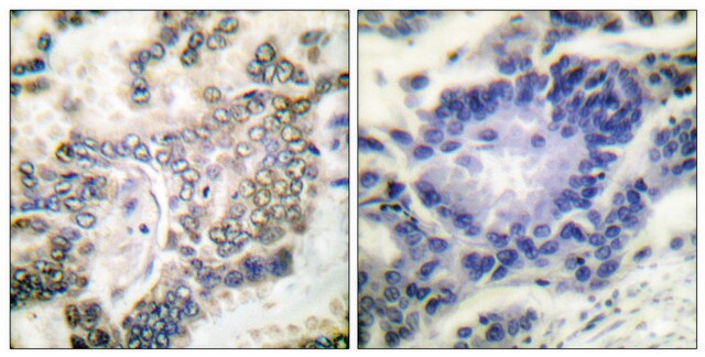 Anti-C/EBP-&#945; antibody produced in rabbit affinity isolated antibody