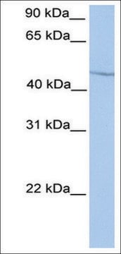 Anti-HOXA13 antibody produced in rabbit affinity isolated antibody