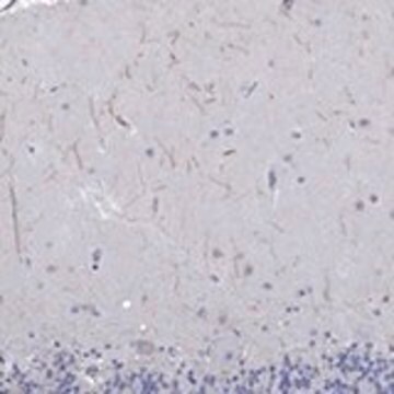 Anti-KRT222 antibody produced in rabbit Prestige Antibodies&#174; Powered by Atlas Antibodies, affinity isolated antibody, buffered aqueous glycerol solution