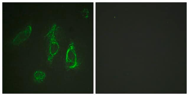 Anti-EPO-R antibody produced in rabbit affinity isolated antibody