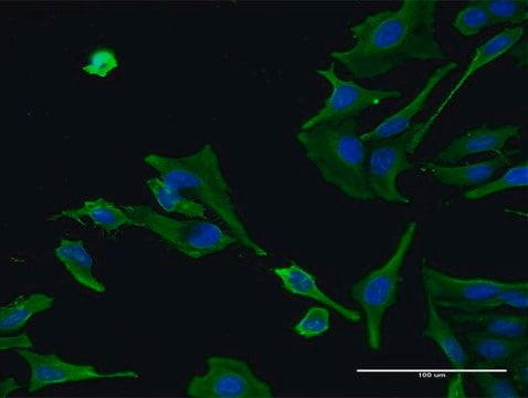 Monoclonal Anti-ALS2 antibody produced in mouse clone 4F10, purified immunoglobulin, buffered aqueous solution