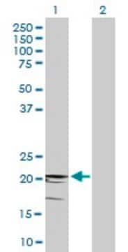 Anti-CD3D antibody produced in mouse purified immunoglobulin, buffered aqueous solution