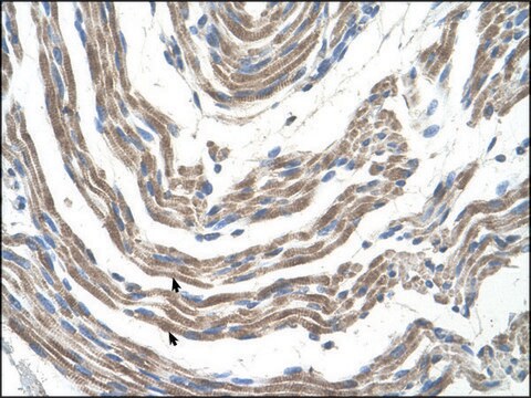 Anti-STK11 antibody produced in rabbit IgG fraction of antiserum