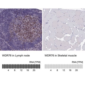 Anti-WDR76 antibody produced in rabbit Prestige Antibodies&#174; Powered by Atlas Antibodies, affinity isolated antibody, buffered aqueous glycerol solution