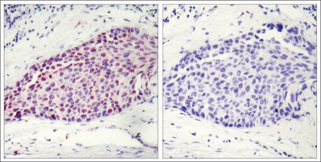 Anti-ATF2 (Ab-112 or 94) antibody produced in rabbit affinity isolated antibody