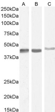 Anti-Smooth Muscle &#945;-Actin antibody produced in goat affinity isolated antibody, buffered aqueous solution