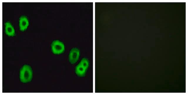 Anti-GPR18 antibody produced in rabbit affinity isolated antibody