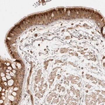 Anti-ANKRD61 antibody produced in rabbit Prestige Antibodies&#174; Powered by Atlas Antibodies, affinity isolated antibody, buffered aqueous glycerol solution