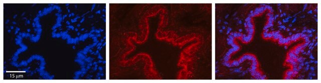 Anti-SRPRB (AB1) antibody produced in rabbit affinity isolated antibody