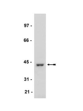 Anti-MKP1 Antibody Upstate&#174;, from rabbit