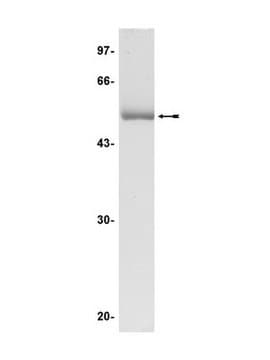 Białko JNK2α2/SAPK1a, nieaktywne, 50 g Unactive, N-terminal His6-tagged, recombinant, full-length, human JNK2&#945;2/SAPK1a unactive, for use in Kinase Assays.