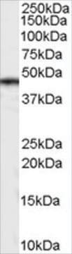 Anti-CASEIN Kinase 1&#948; antibody produced in goat affinity isolated antibody, buffered aqueous solution