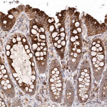 Anti-KIF2B antibody produced in rabbit Prestige Antibodies&#174; Powered by Atlas Antibodies, affinity isolated antibody, buffered aqueous glycerol solution, ab3