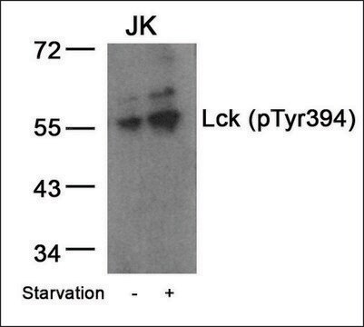 Anti-phospho-LCK (pTyr394) antibody produced in rabbit affinity isolated antibody