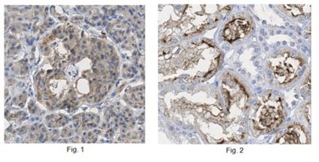 Anti-ALKBH1 Antibody from rabbit, purified by affinity chromatography