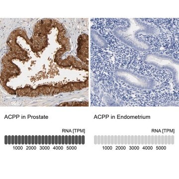 Anti-ACPP antibody produced in rabbit Prestige Antibodies&#174; Powered by Atlas Antibodies, affinity isolated antibody, buffered aqueous glycerol solution