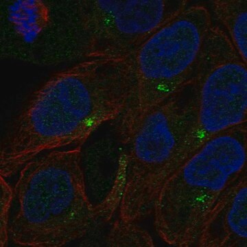 Anti-C1Orf146 Antibody Produced In Rabbit Prestige Antibodies&#174; Powered by Atlas Antibodies, affinity isolated antibody, buffered aqueous glycerol solution